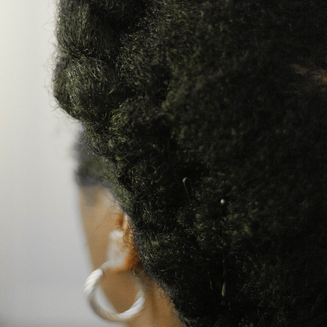 Dry Scalp Remedies For You