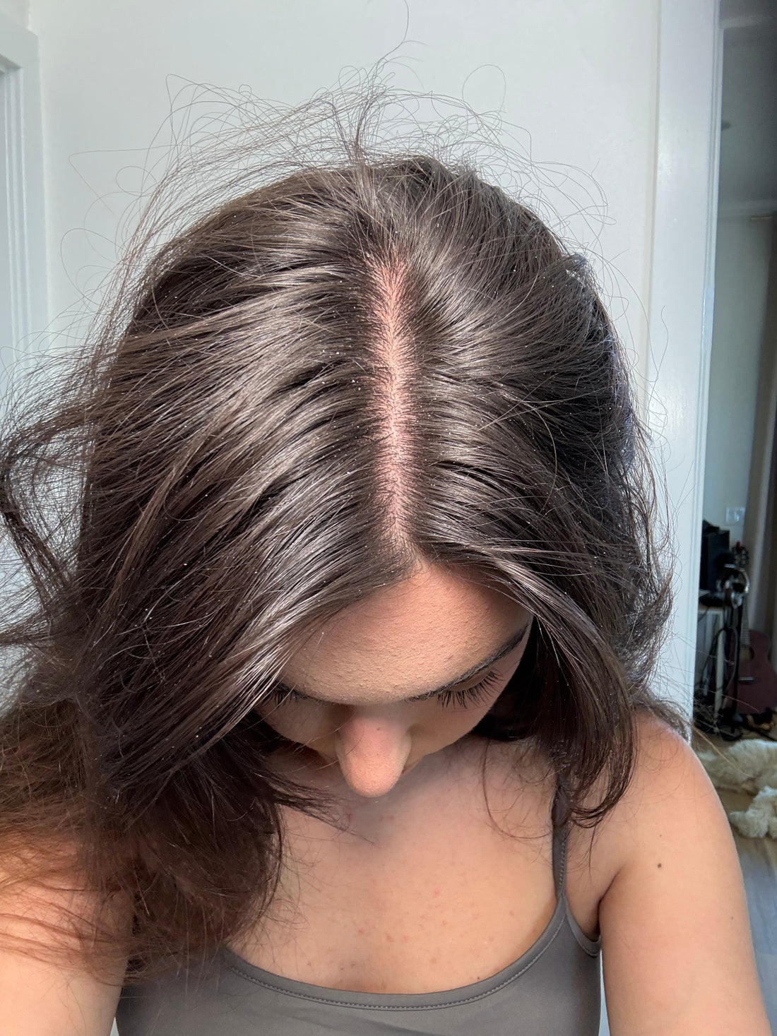 Dermatitis: Causes, Symptoms, Treatment & Management