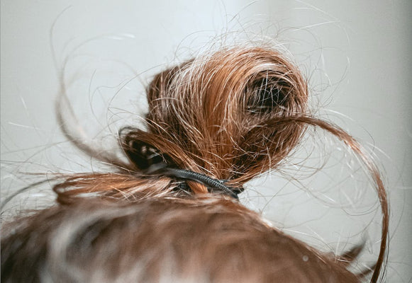 Get Rid of Crusty Scalp Build-Up