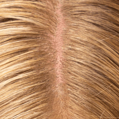 Atopic Dermatitis: Causes, Symptoms & Treatment
