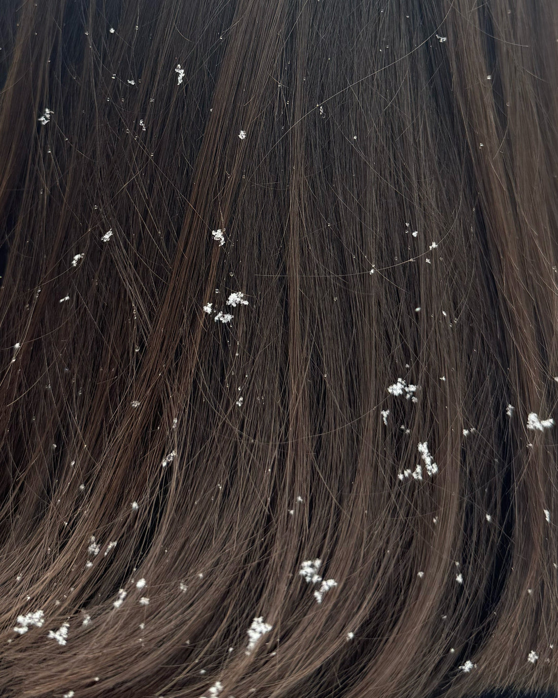 Image of long, black hair with white flakes