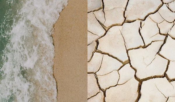 Head-To-Head: Psoriasis vs. Seborrheic Dermatitis