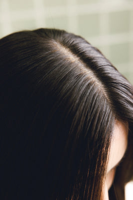 Scalp Psoriasis vs Dandruff: How to Tell the Difference