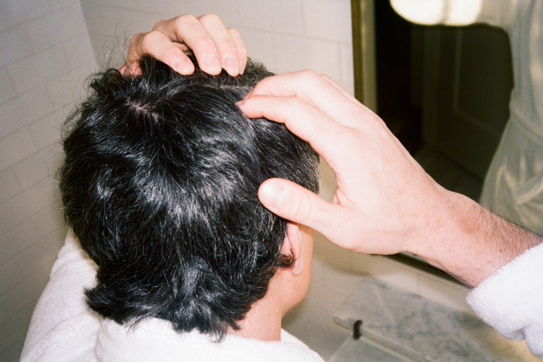 Seborrheic Dermatitis: Causes, Symptoms & Treatment